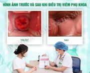 dia-chi-chuyen-kham-viem-phu-khoa-o-ha-noi-cam-ket-cua-da-khoa-quoc-te